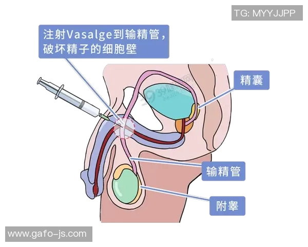 体育锻炼对男性生殖健康的积极影响及其对阴茎长度的潜在促进作用分析